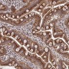 Immunohistochemical staining of human duodenum shows strong granular cytoplasmic positivity in glandular cells.
