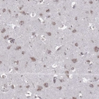 Immunohistochemical staining of human cerebral cortex shows weak granular cytoplasmic positivity in neuronal cells as expected.