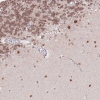 Anti-TLE2 Antibody