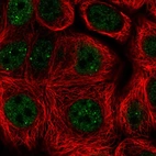 Immunofluorescent staining of human cell line MCF7 shows localization to nuclear bodies.