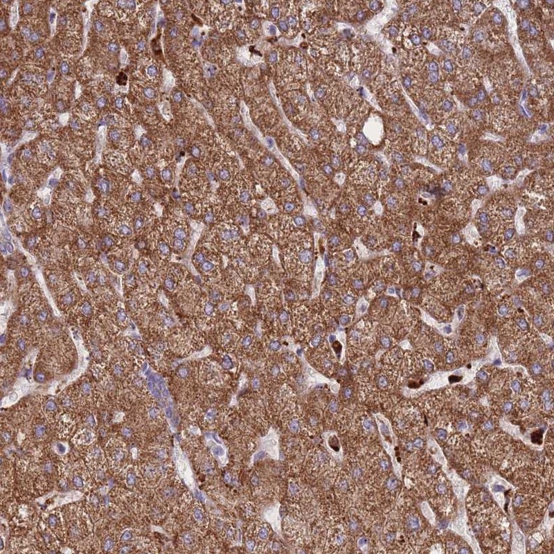 Anti-TRIM61 Antibody