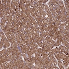 Anti-TRIM61 Antibody