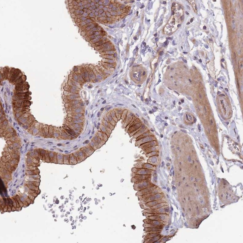 Anti-OR4C3 Antibody