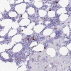 Anti-ZFP37 Antibody