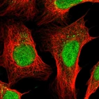 Immunofluorescent staining of human cell line U-2 OS shows localization to nucleus & vesicles.