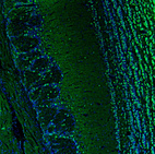 Anti-BCL11B Antibody