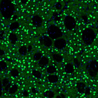 Immunofluorescence staining of mouse basal forebrain shows moderate to strong positivity in neurons in the caudate putamen.