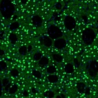 Immunofluorescence staining of mouse basal forebrain shows moderate to strong positivity in neurons in the caudate putamen.
