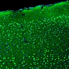 Immunofluorescence staining of mouse brain shows moderate to strong positivity in neuronal cells in the cerebral cortex.