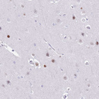 Immunohistochemical staining of human cerebral cortex shows weak to moderate nuclear positivity in neurons.