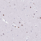 Anti-BCL11B Antibody