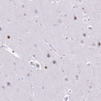 Immunohistochemical staining of human cerebral cortex shows weak to moderate nuclear positivity in neurons.