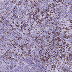 Immunohistochemical staining of human lymph node shows moderate to strong nuclear positivity in non - germinal center cells.