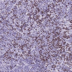 Immunohistochemical staining of human lymph node shows moderate to strong nuclear positivity in non - germinal center cells.