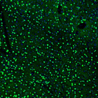 Immunofluorescence staining of mouse basal forebrain shows strong positivity in neurons in the accumbens nucleus, shell.