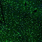 Immunofluorescence staining of mouse basal forebrain shows strong positivity in neurons in the accumbens nucleus, shell.