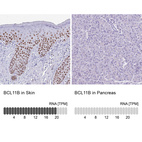Immunohistochemistry analysis in human skin and pancreas tissues using HPA049117 antibody. Corresponding BCL11B RNA-seq data are presented for the same tissues.