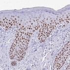 Immunohistochemical staining of human skin shows moderate to strong nuclear positivity in epidermal cells.