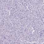 Immunohistochemical staining of human pancreas shows no nuclear positivity in exocrine glandular cells as expected.