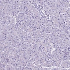 Immunohistochemical staining of human pancreas shows no nuclear positivity in exocrine glandular cells as expected.