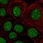 Immunofluorescent staining of human cell line MCF7 shows localization to nucleus & nucleoli fibrillar center.