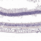 Anti-SLC1A7 Antibody