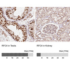 Anti-RFC4 Antibody