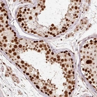 Immunohistochemical staining of human testis shows high expression.