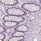 Immunohistochemical staining of human rectum shows no positivity in glandular cells as expected.