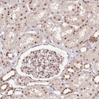 Immunohistochemical staining of human kidney shows low expression as expected.