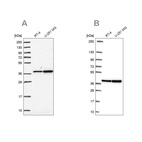 Anti-RFC4 Antibody