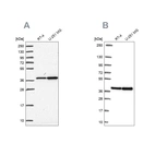 Western blot analysis using Anti-RFC4 antibody HPA049123 (A) shows similar pattern to independent antibody HPA058507 (B).