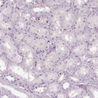 Immunohistochemical staining of human kidney shows no positivity in cells in tubules as expected.