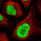 Immunofluorescent staining of human cell line U-2 OS shows localization to nucleoplasm.