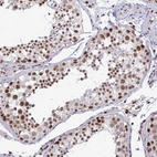 Anti-WBP11 Antibody