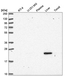 Western blot analysis in human cell line RT-4, human cell line U-251 MG, human plasma, human liver tissue and human tonsil tissue.