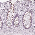 Immunohistochemical staining of human rectum shows moderate cytoplasmic positivity in glandular cells.