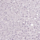 Immunohistochemical staining of human liver shows no positivity in hepatocytes as expected.
