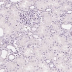 Immunohistochemical staining of human kidney shows no positivity in cells in tubules as expected.