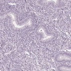 Immunohistochemical staining of human endometrium shows no positivity in glandular cells as expected.