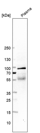 Western blot analysis in human plasma.