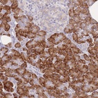 Anti-ZNF510 Antibody