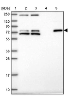 Lane 1: Marker [kDa] 250, 130, 95, 72, 55, 36, 28, 17, 10_br/_Lane 2: Human cell line RT-4_br/_Lane 3: Human cell line U-251MG sp_br/_Lane 4: Human plasma (IgG/HSA depleted)_br/_Lane 5: Human liver tissue