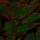 Anti-ZNF510 Antibody