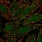 Immunofluorescent staining of human cell line SiHa shows localization to nucleoplasm, plasma membrane & vesicles.