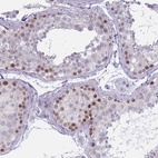 Anti-ZKSCAN2 Antibody