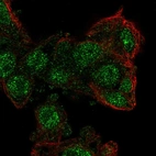 Immunofluorescent staining of human cell line Hep G2 shows localization to nucleoplasm.