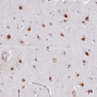 Immunohistochemical staining of human cerebral cortex shows strong nuclear positivity in neuronal cells.