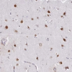 Immunohistochemical staining of human cerebral cortex shows strong nuclear positivity in neuronal cells.