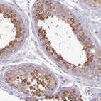 Immunohistochemical staining of human testis shows strong membranous positivity in spermatids and spermatocytes.